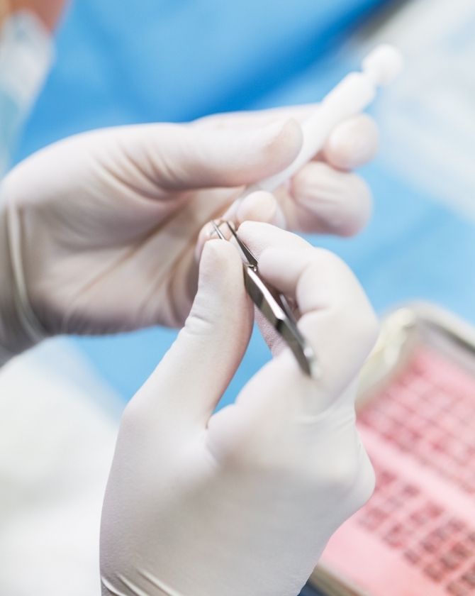 Procédure de greffe de cheveux